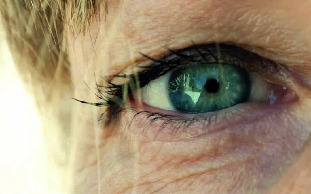 Rides sous les yeux, Ride de la patte d’oie, ride du lion… le Jetpeel ® meilleure solution alternative à l’injection d’acide hyaluronique sans aiguille