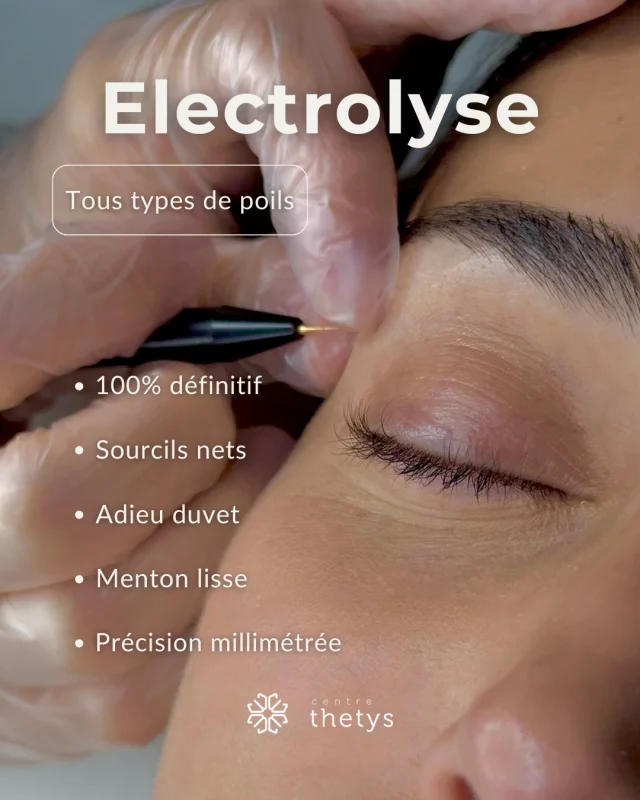 L’électrolyse est la solution définitive contre les poils indésirables.

Un traitement efficace et durable pour se libérer des contraintes quotidiennes et retrouver une peau lisse en toute sérénité. 

L’électrolyse répond aussi aux besoins spécifiques des personnes concernées par le SOPK 🤍

#electrolyse #epilationdefinitive #syndromedesopk #solutionepilation #poilsindesirables #sopk