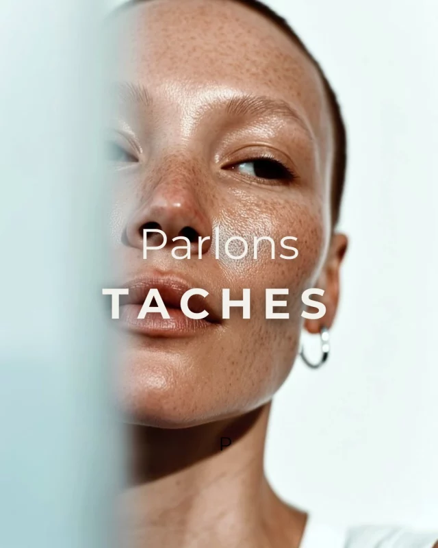 Taches, masque de grossesse, marques d’acné ou soleil : le soin Cosmelan® corrige tout.

Une méthode révolutionnaire, maîtrisée par nos expertes Thetys.

📅 Réservez votre diagnostic offert dès maintenant et révélez l’éclat naturel de votre peau. (lien en bio)

#cosmelan #cosmelanpro #depigmentation #antitaches #soinvisage #hyperpigmentation #soinprofessionnel  #masquegrossesse #tachespigmentaires #tachesvisage #mesoestetic